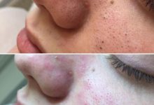 Photo of Важность умывания и чистоты